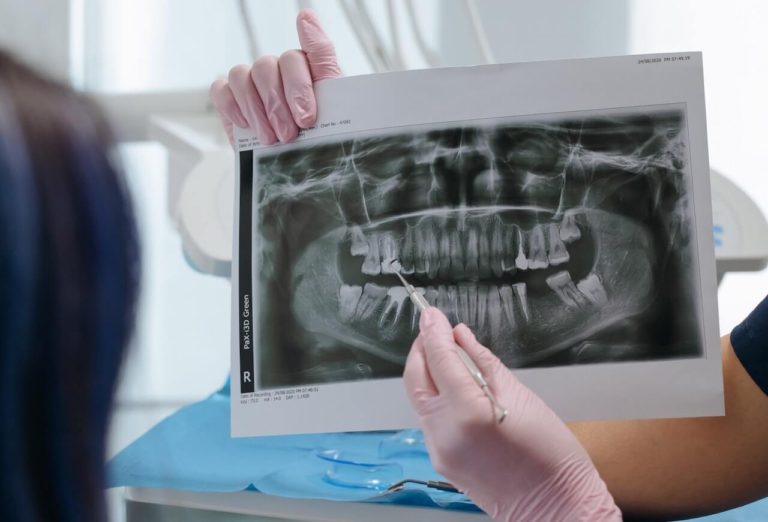 dental x rays